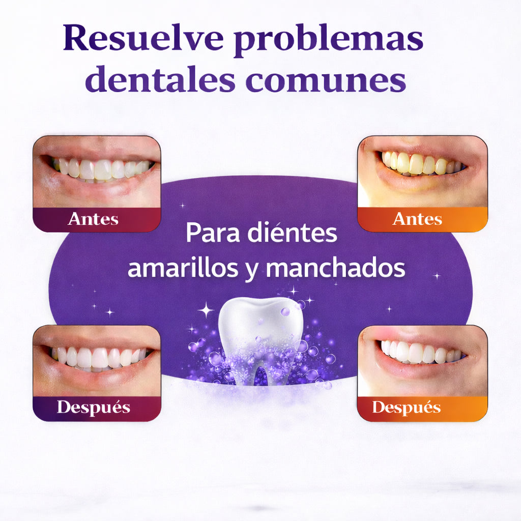 Dientes más blancos desde casa, sin dolor ni dentista.